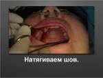 Стоматологический лайфхак!