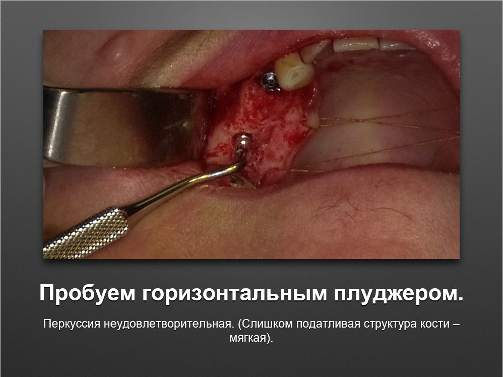 Screenshot_33