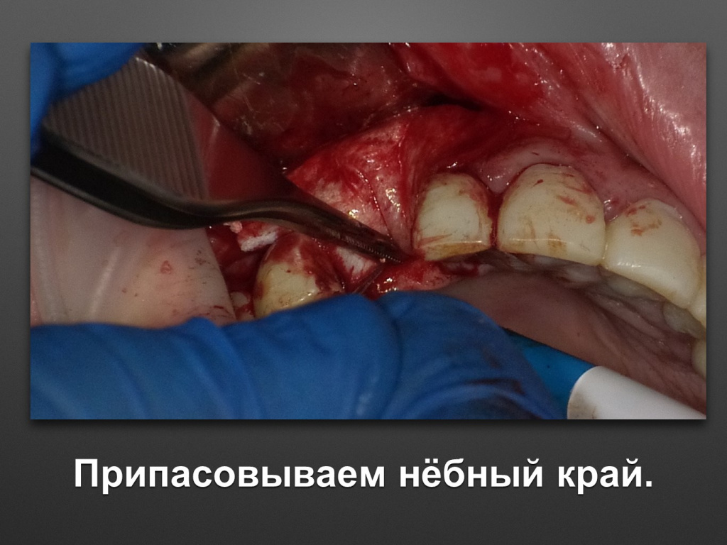 БАЛДЕЙ НОГА