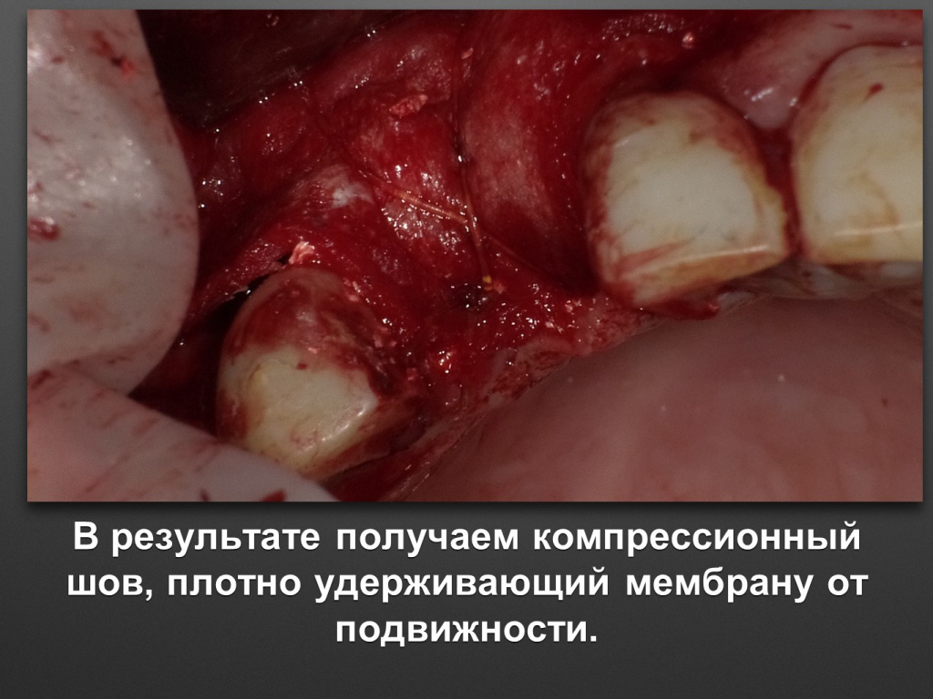 БАЛДЕЙ НОГА
