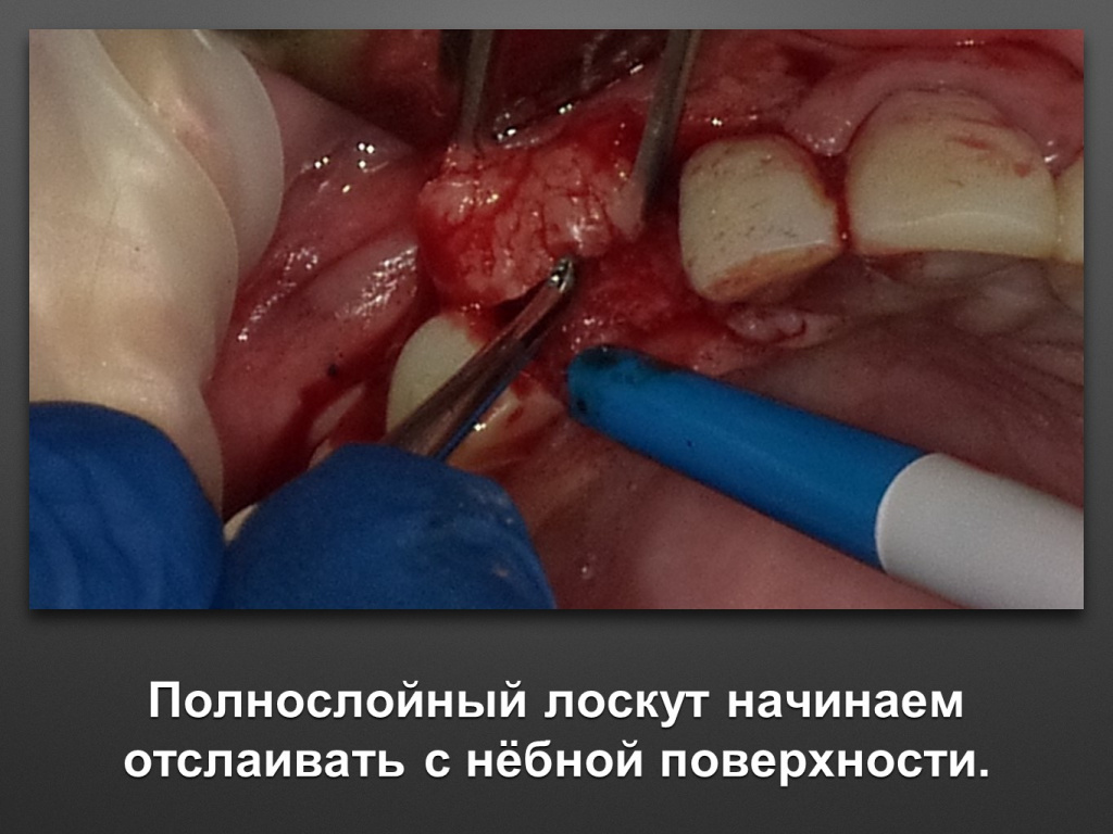 БАЛДЕЙ НОГА