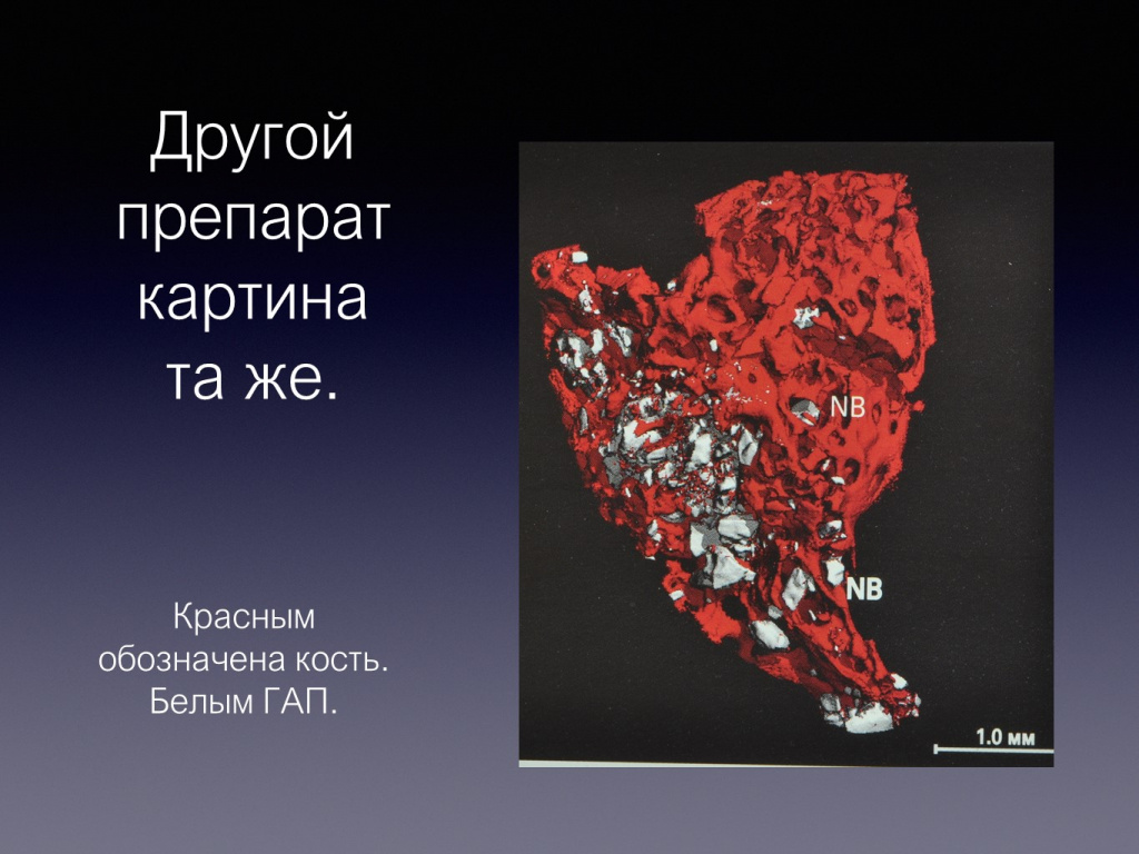 Принцип направленной костной регенерации