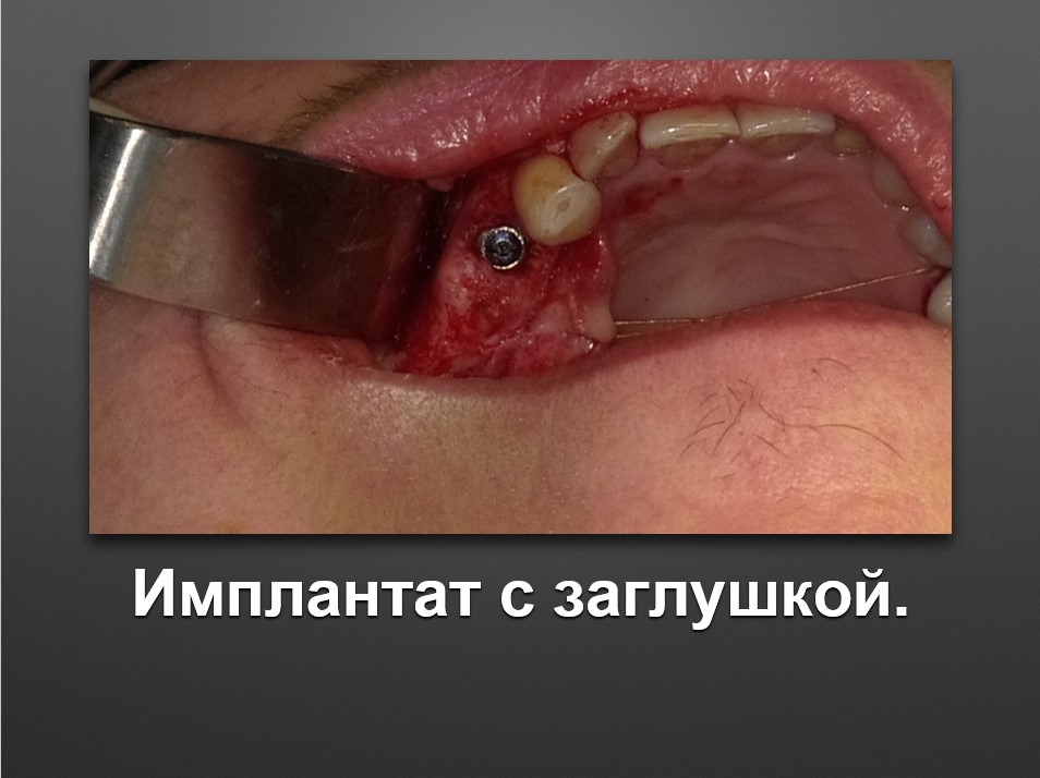Screenshot_30