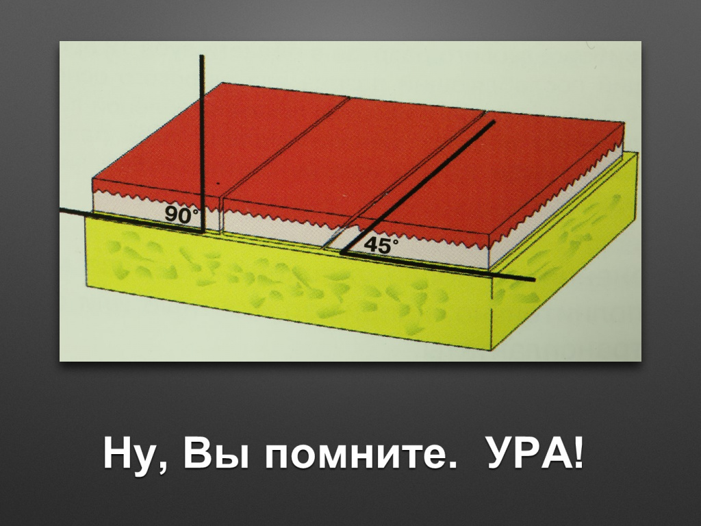 Биоимплант ГАП. Имплантация в дистальном отделе