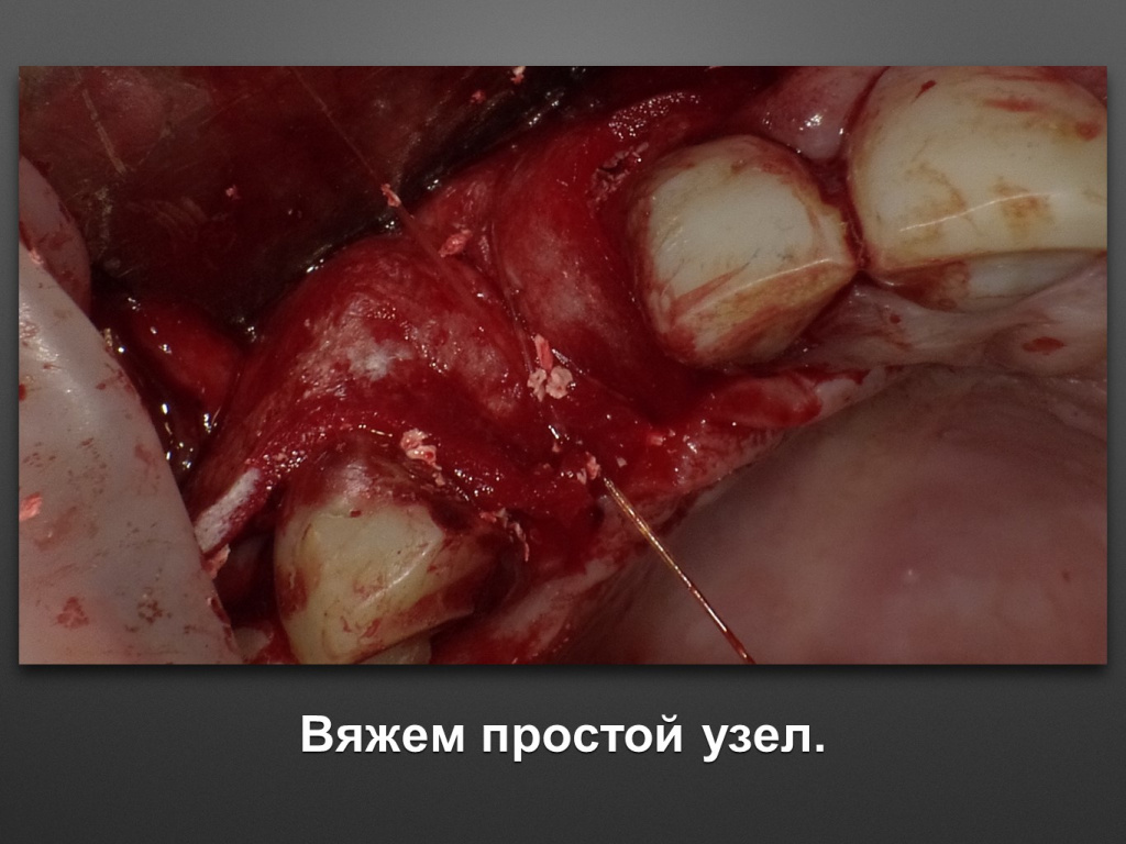 БАЛДЕЙ НОГА