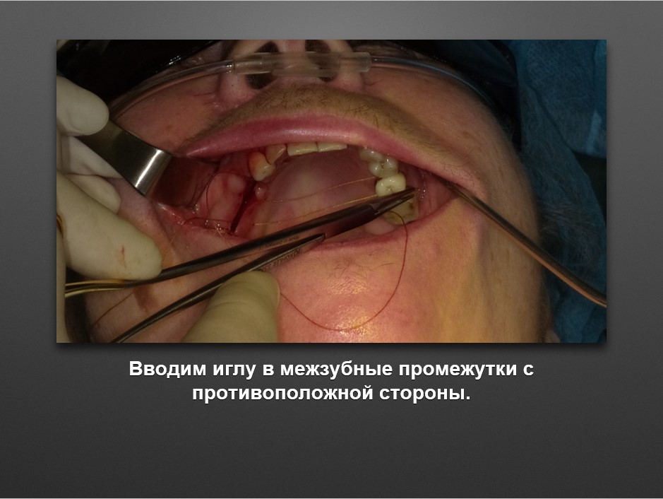 Screenshot_6