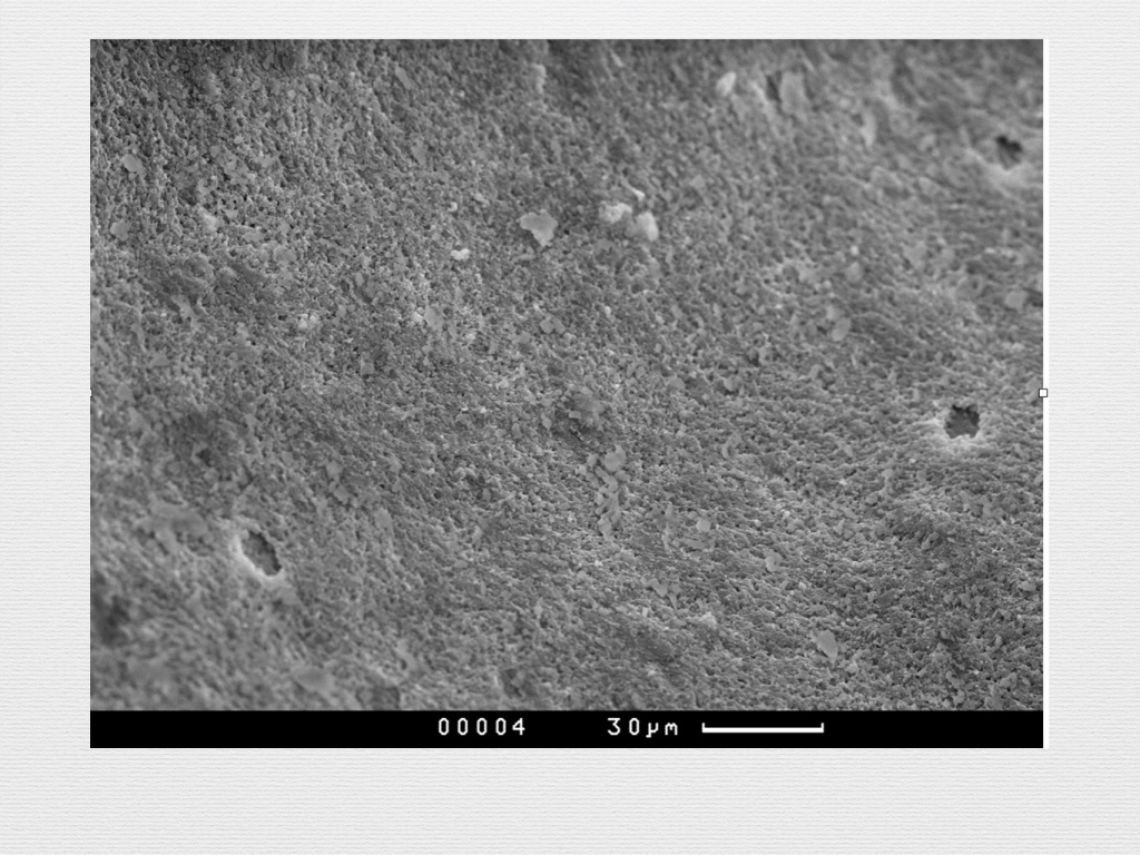 Принцип направленной костной регенерации