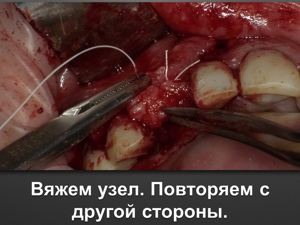 БАЛДЕЙ НОГА