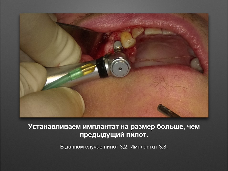 Screenshot_28