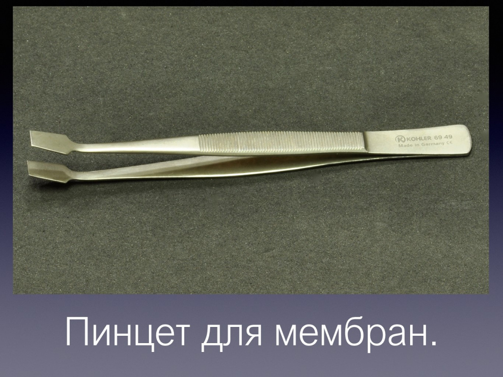 Постановка импланта
