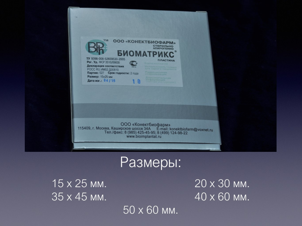 Принцип направленной костной регенерации