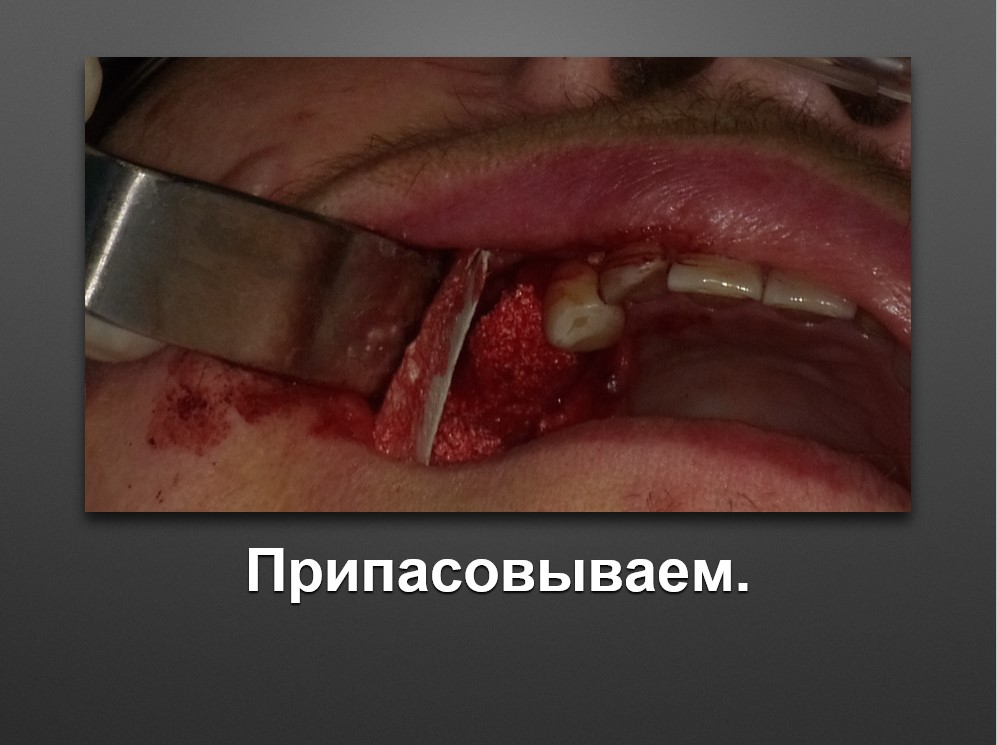 Screenshot_55