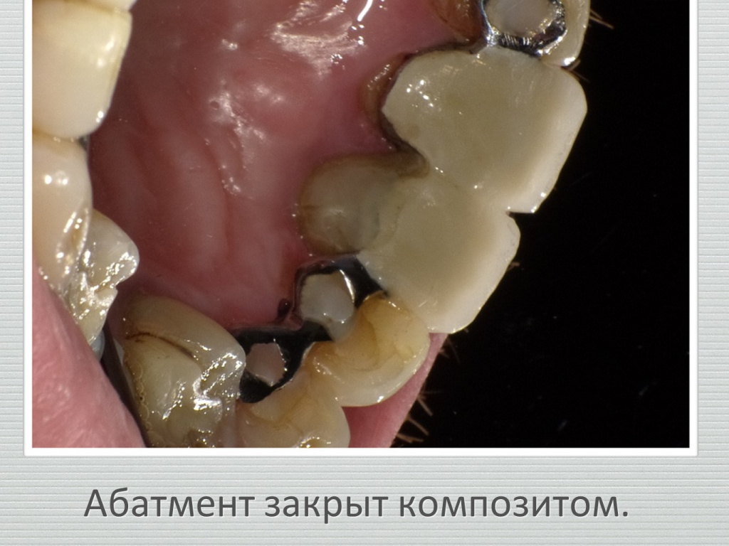 Ранозаживление