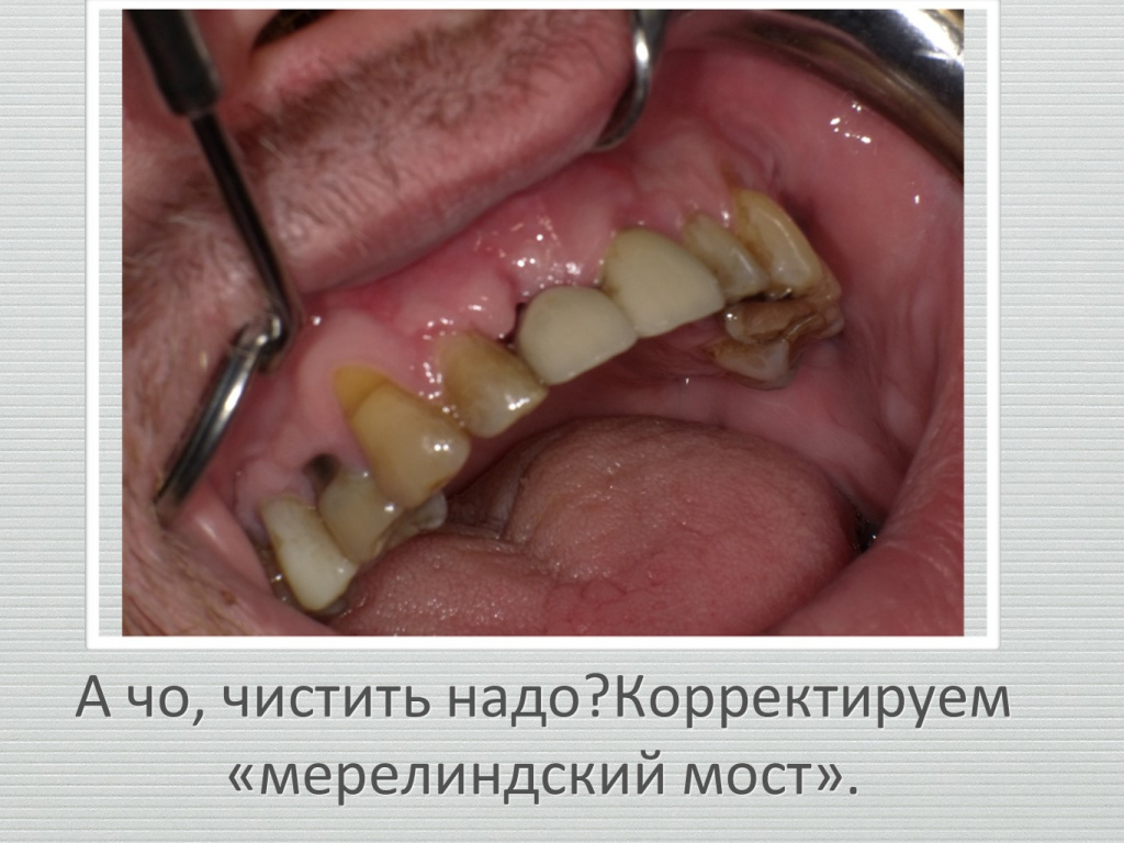 Ранозаживление