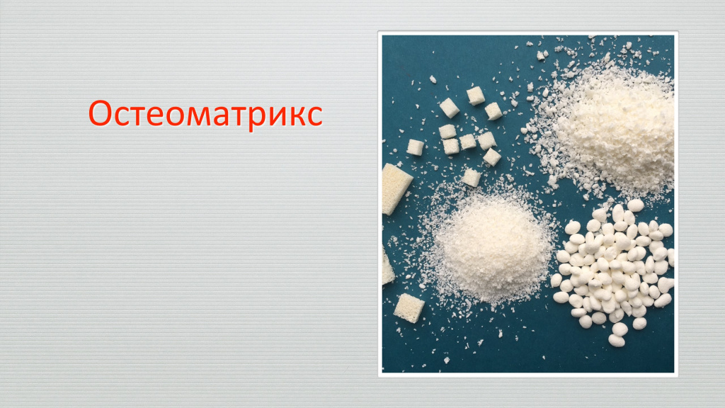 Технология ОСТЕОМАТРИКС. Там, где действительно нужна кость