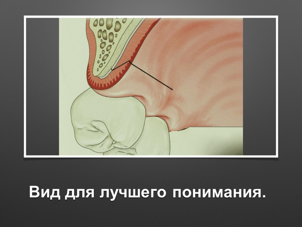 БАЛДЕЙ НОГА