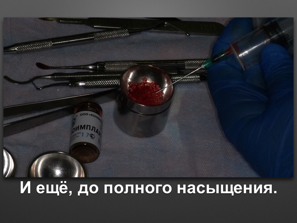 БАЛДЕЙ НОГА