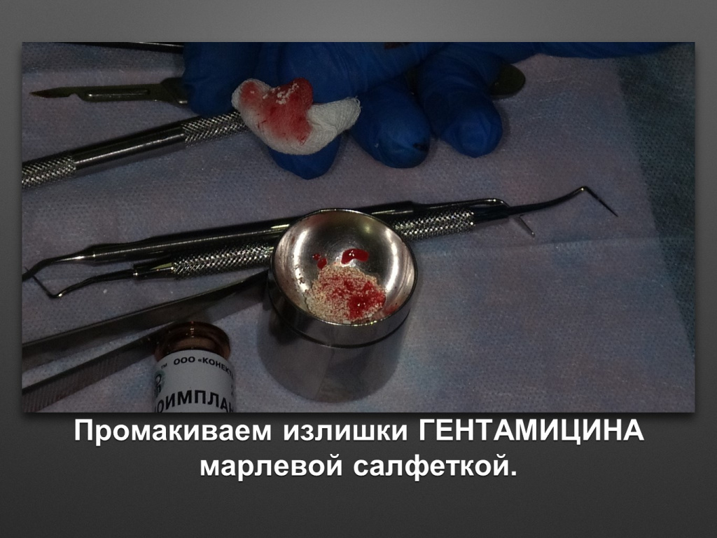 БАЛДЕЙ НОГА