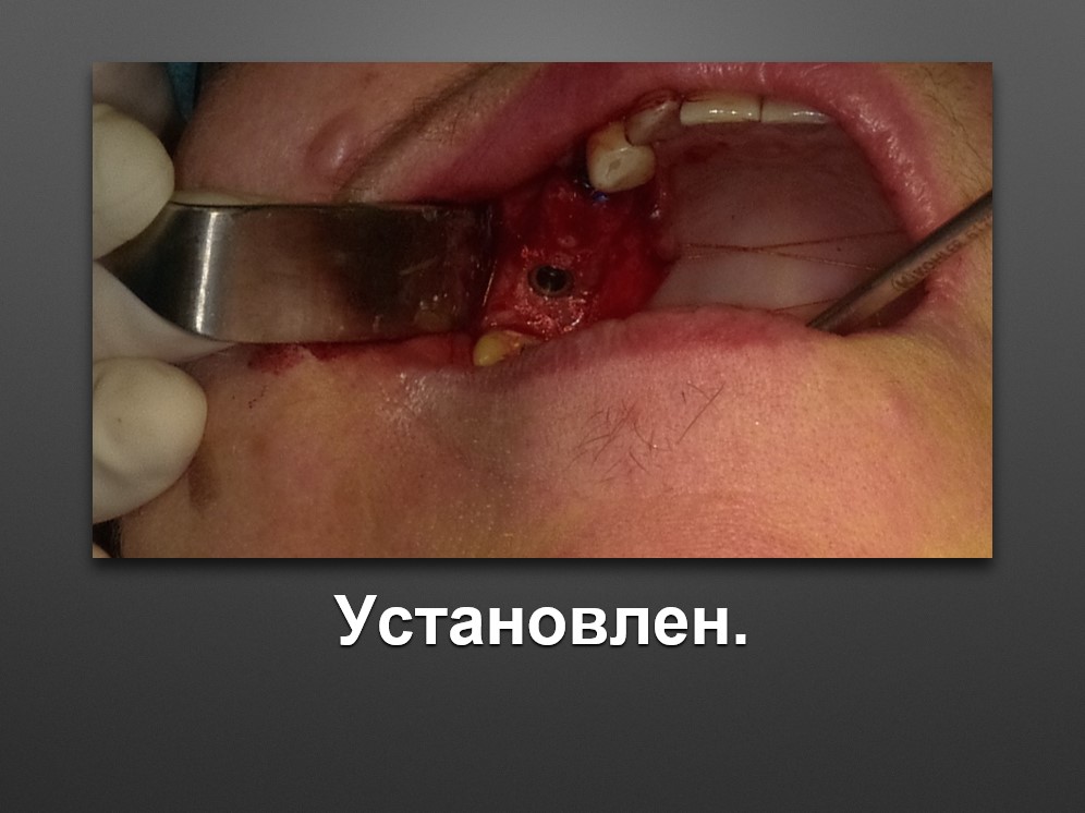 Screenshot_49