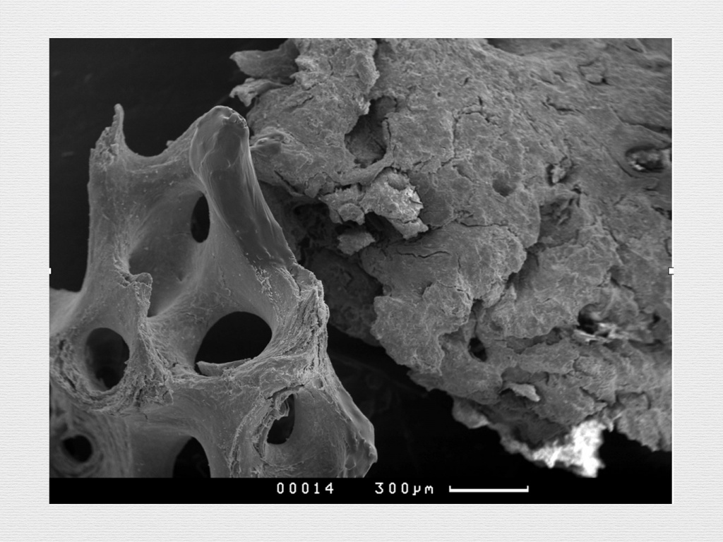 Принцип направленной костной регенерации