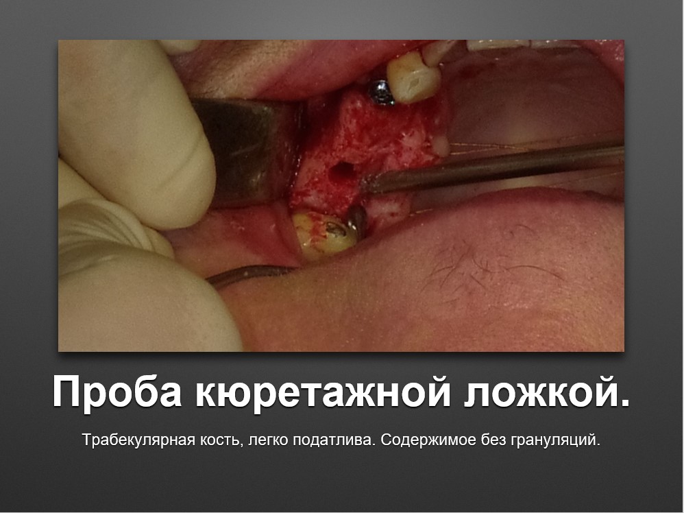 Screenshot_34