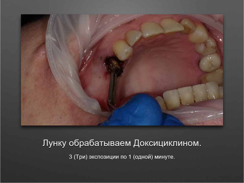 Screenshot_4