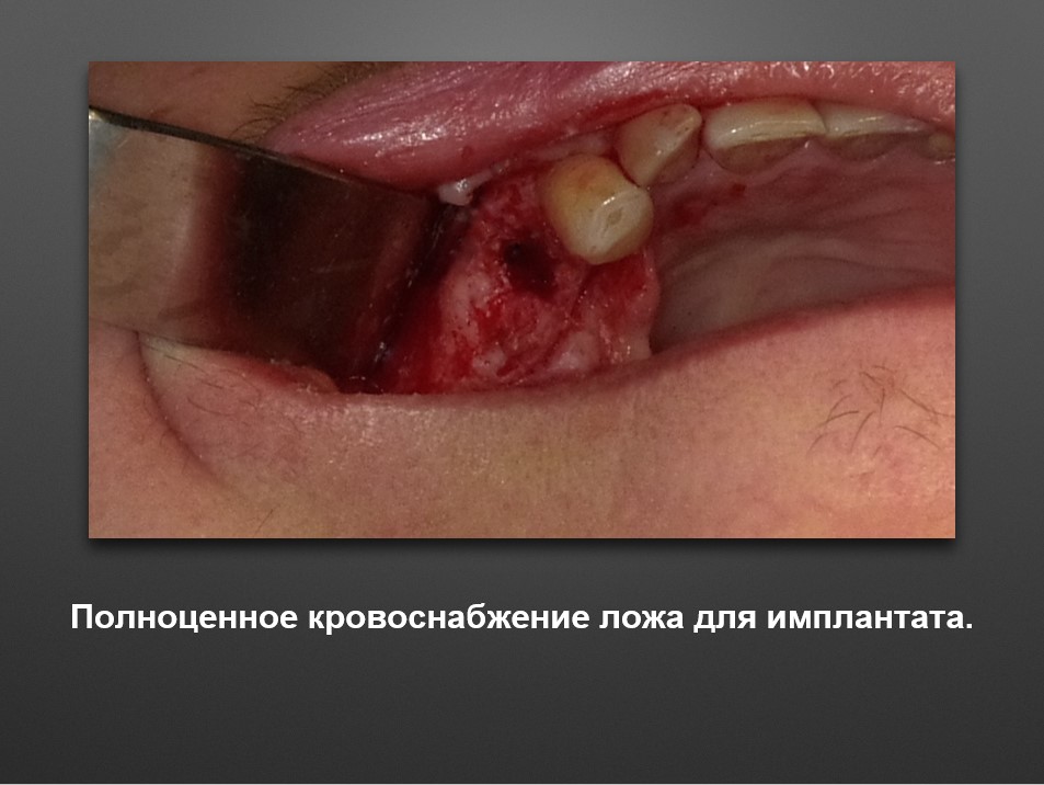 Screenshot_27