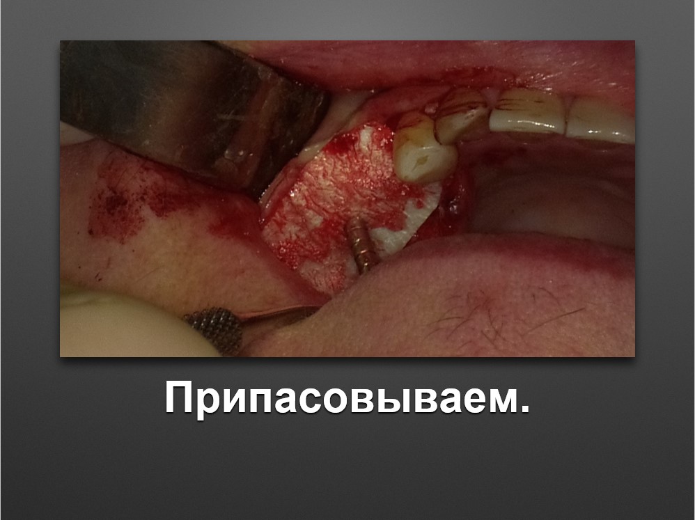Screenshot_56