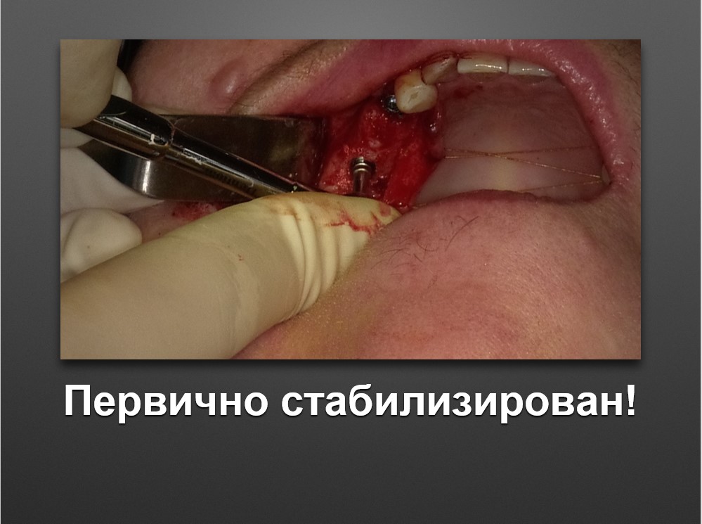 Screenshot_50