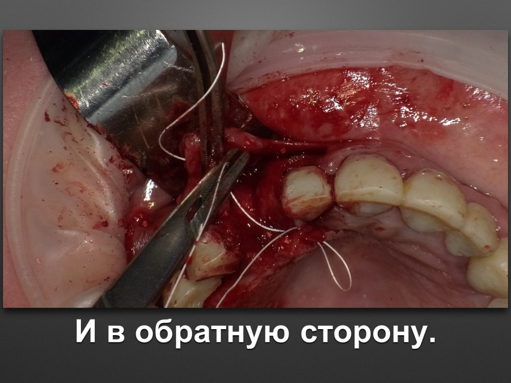 БАЛДЕЙ НОГА