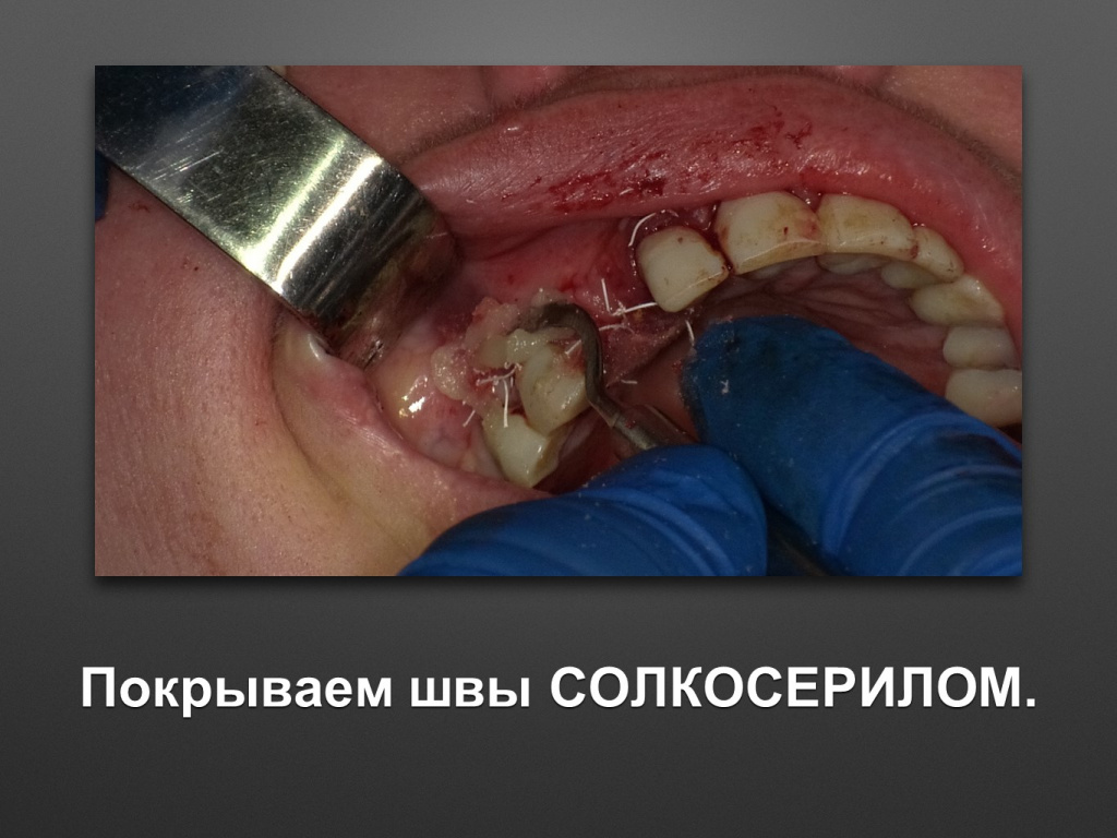 БАЛДЕЙ НОГА