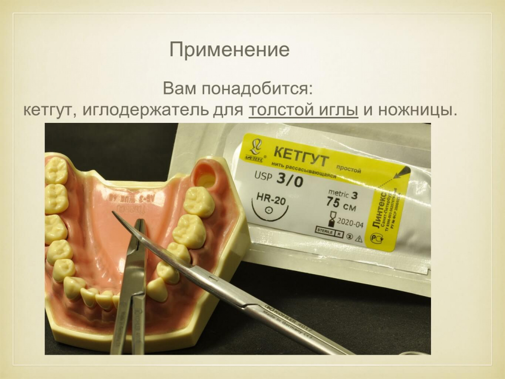 ЛАЙФХАК - Профилактика альвеолита