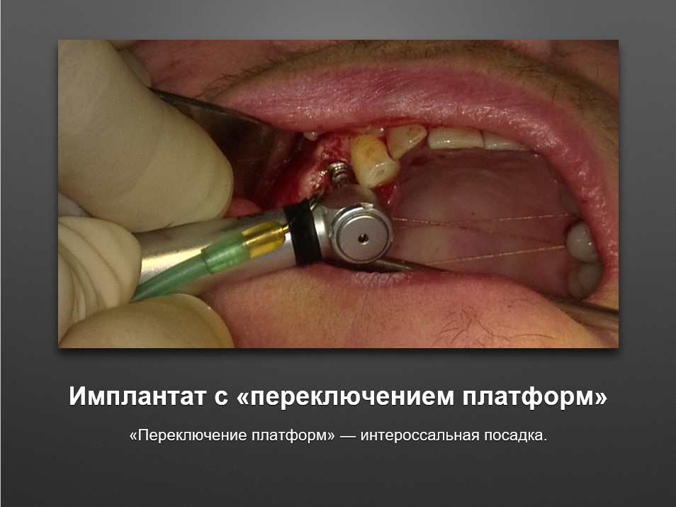 Screenshot_29