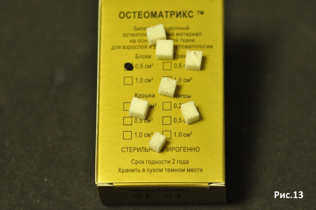 расщепление альвеолярного отростка