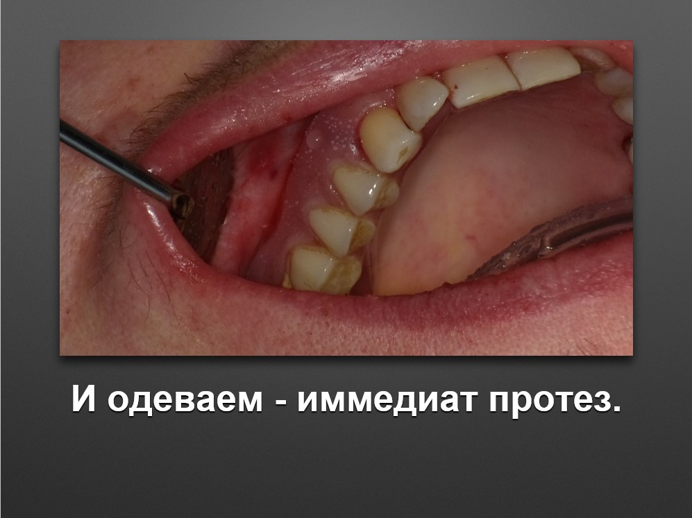 Screenshot_60