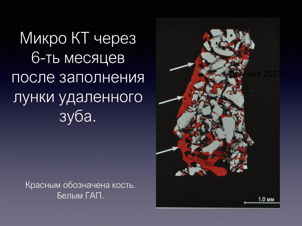 Принцип направленной костной регенерации