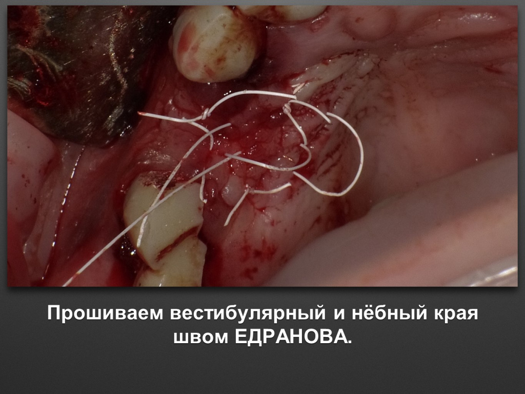 БАЛДЕЙ НОГА