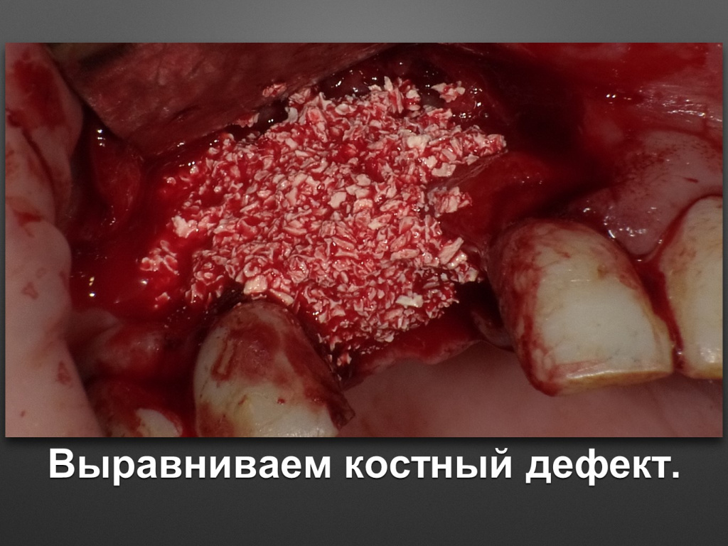 БАЛДЕЙ НОГА