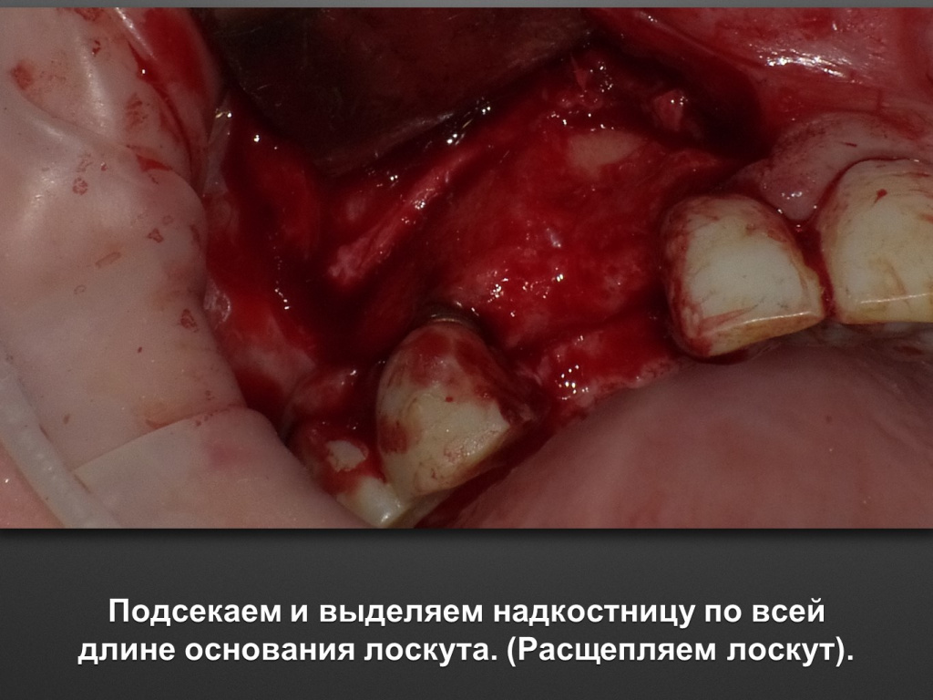 БАЛДЕЙ НОГА