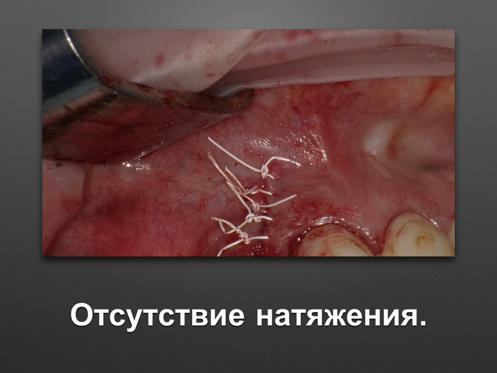 БАЛДЕЙ НОГА