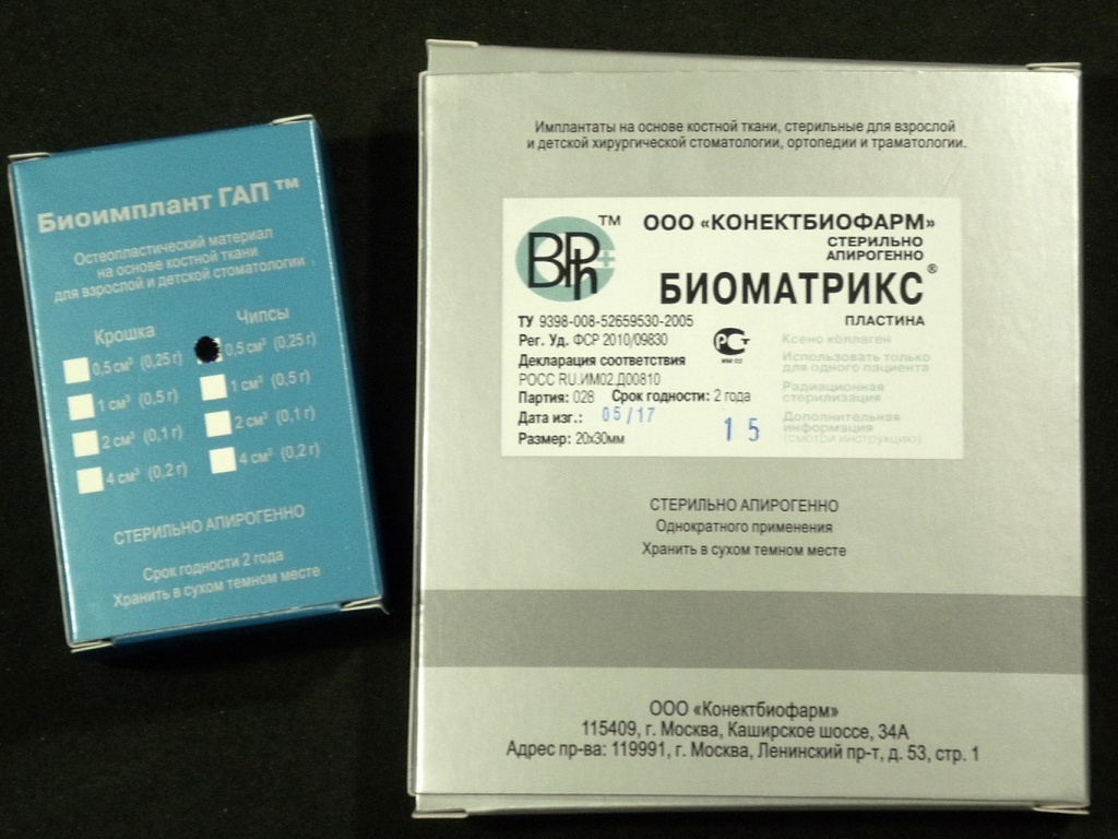 Постановка импланта