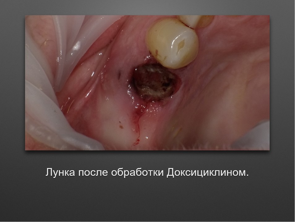 Screenshot_6