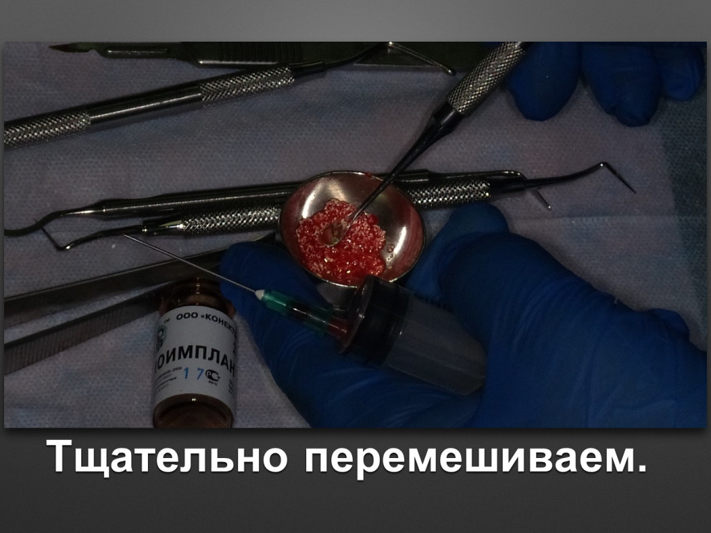 БАЛДЕЙ НОГА