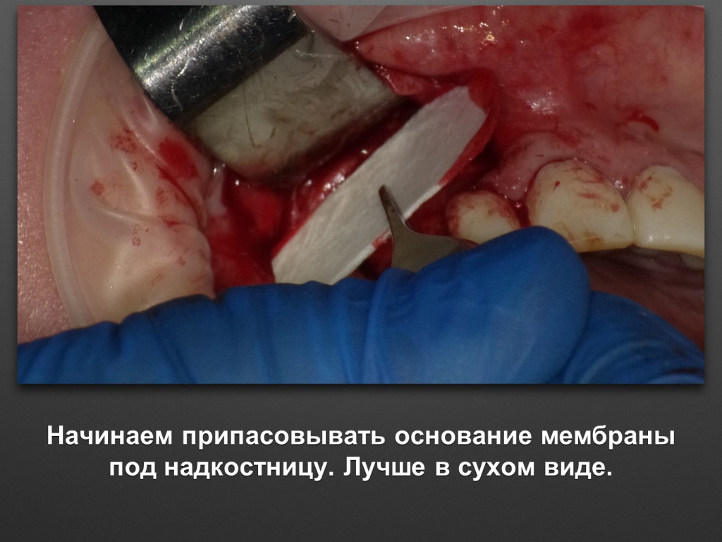 БАЛДЕЙ НОГА