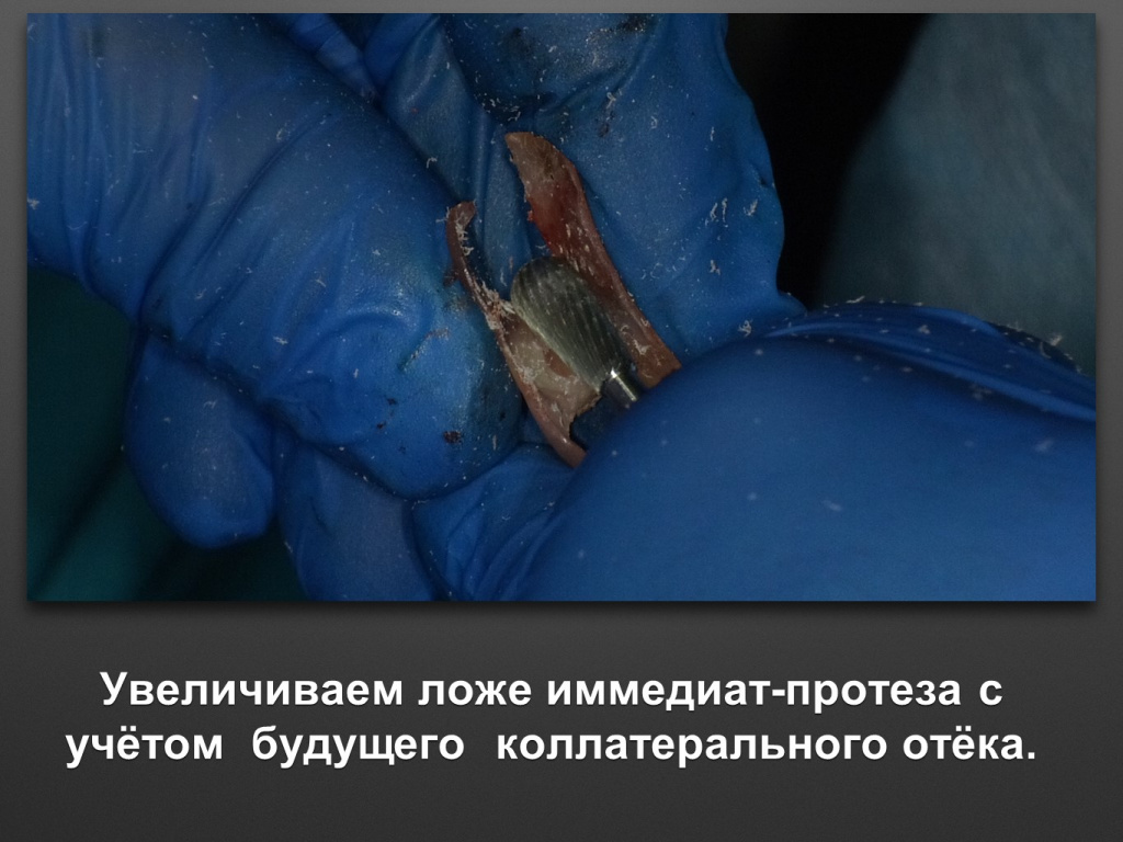 БАЛДЕЙ НОГА