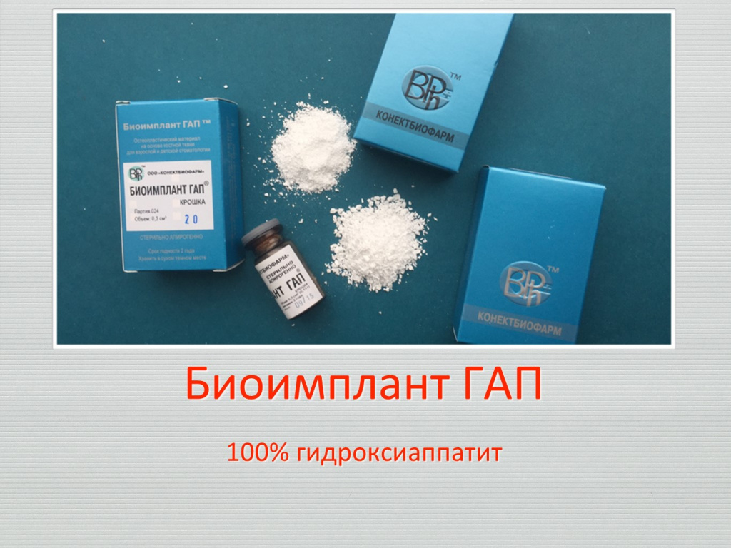 Принцип направленной костной регенерации