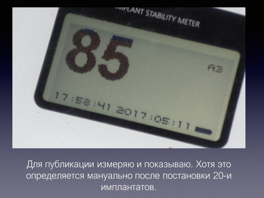 Постановка имплантата после презервации