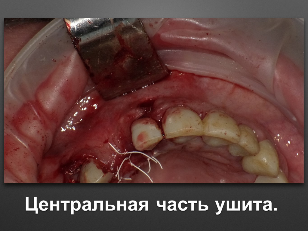 БАЛДЕЙ НОГА