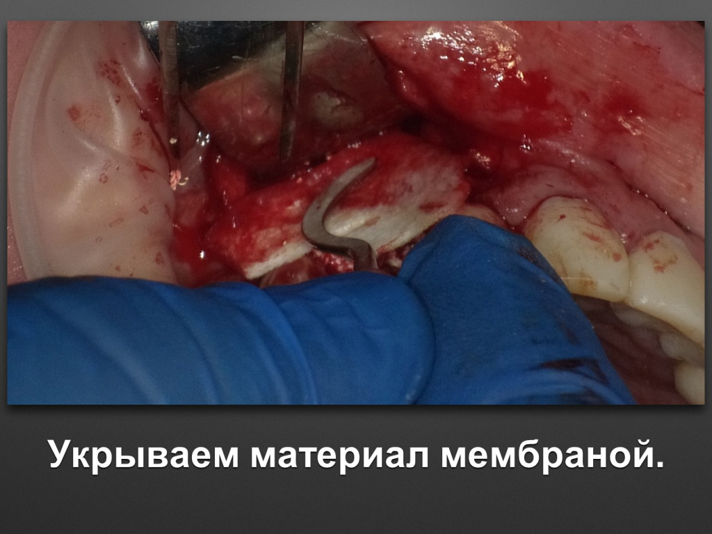 БАЛДЕЙ НОГА