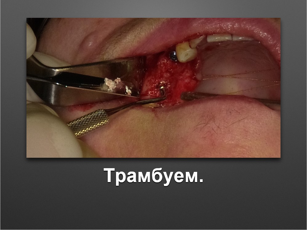 Screenshot_38